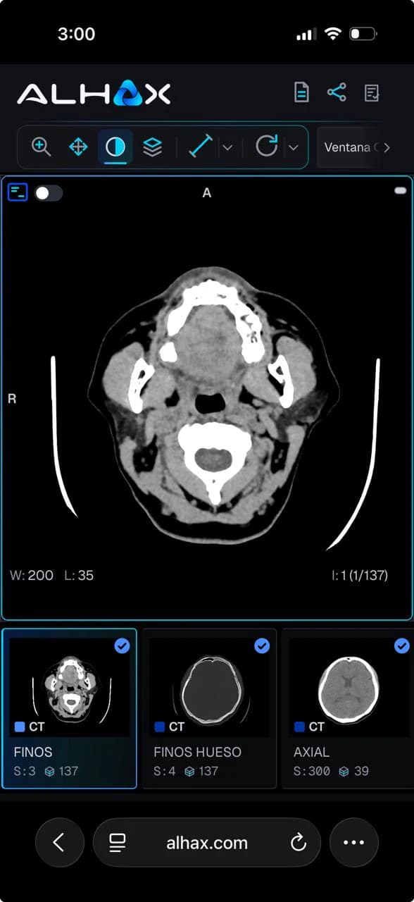 El visor de ALHAX en el navegador de un teléfono: corte axial de tomografía de cuello y, debajo, el carrusel con las series del estudio.